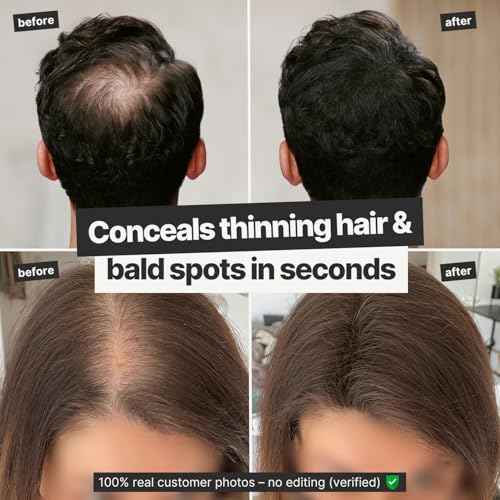 IMPERIO Hair Building Fibers for Thinning Hair - 26g Premium Hair Fibers for Women & Men - Dark Brown