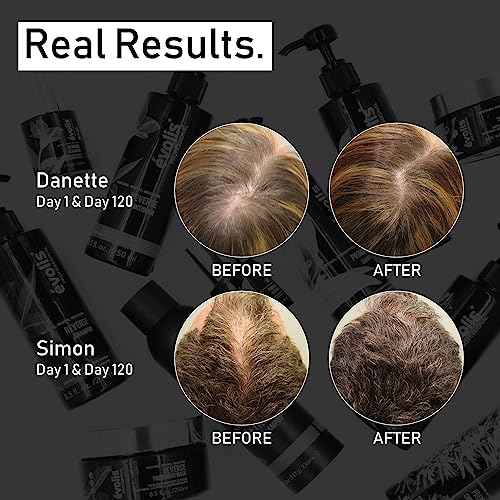 EVOLIS Reverse Thickening Conditioner for Fuller-Looking Hair ? Keratin Treatment & Formula for Thinning Hair (8.5 fl oz)