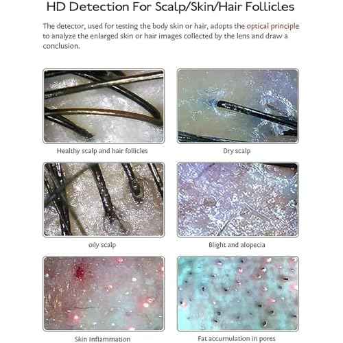 Skin Hair Scalp Detector Analyzer,15inch LCD Screen Digital Skin Detector, Multifunctional Scalp Detector Machine, Rechargeable Hair Follicle Skin Analyser Machine