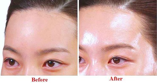 WHITESILK Ultimate Youth Elixir : LACTOFERRIN (liposome), Micro-Peptide C3™ & Volufiline with HyalFerrin™ Technology Face Serum (40ml / 1.32oz)