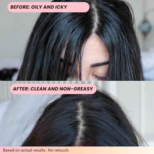 FoxyBae Volumizing Dry Shampoo Spray for Women - With Biotin for Hair Growth - For Dark, Brunette & Blonde Hair - Refreshing & Non-Toxic