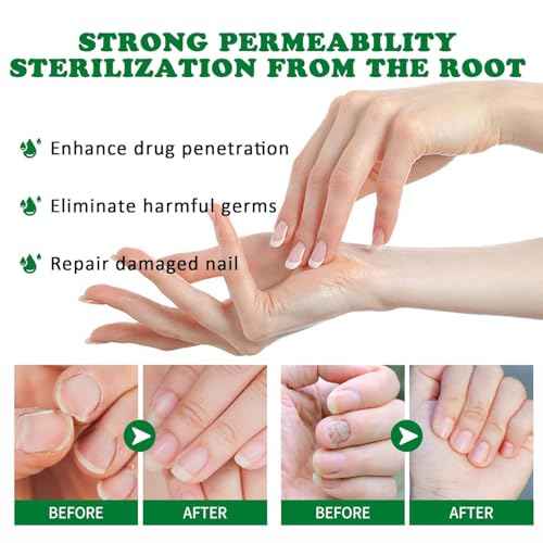 7 days Nail Treatment, Ginger Nail Treatment, Nail Growth Serum, Ginger Nail Serum, Nail Nutrient Oil Strengthener Oil (2 PCS)