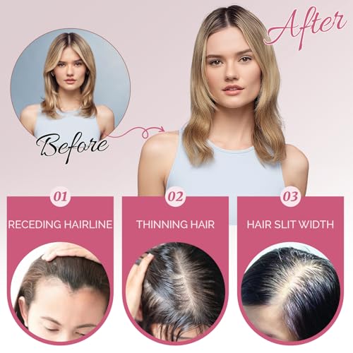Hair Toppers for Women Upgrade Swiss Lace Base Human Hair Topper with No Bangs 360¡Æ3D Cover Fake Bangs Hair Topper with Thinning (Ombre Light Brown with Blond Highlight)