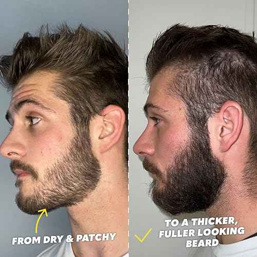 The Beard Club Signature Beard Growth Kit - Derma Roller, Beard Growth Oil, Beard Growth Vitamins, Vitamin Spray & Beard Brush - Gift Set