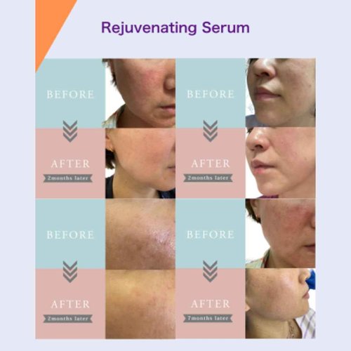 MizumaRi Wrinkle & Lift-Up Face Serum for Dry & Sensitive Skin – Firming & Elasticity Gel, 50ml
