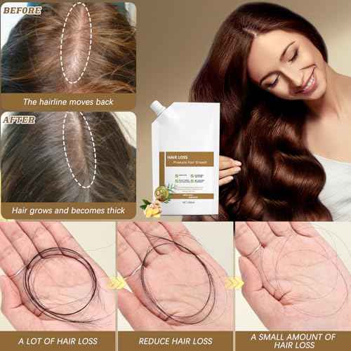 300ML Anti-Hair Fall Hair Loss Shampoo, Anti-Hair Fall Promote Hair Growth Shampoo, Rich in Various Plant Extracts, for all Hair Types (1Pcs)