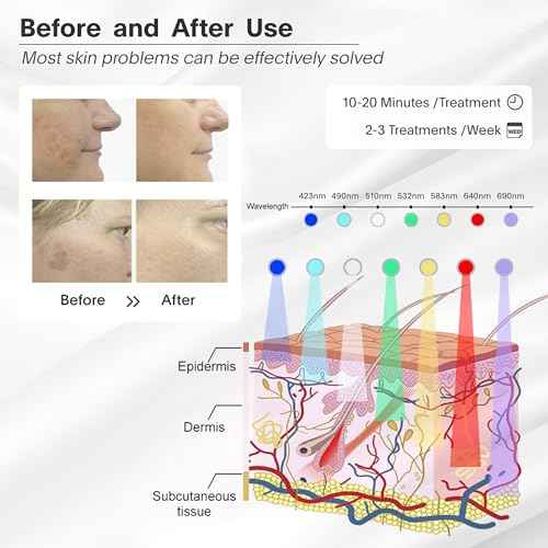 Red-Light-Therapy-for-Face, 7 Color Light Therapy LED Face Mask SPA Equipment