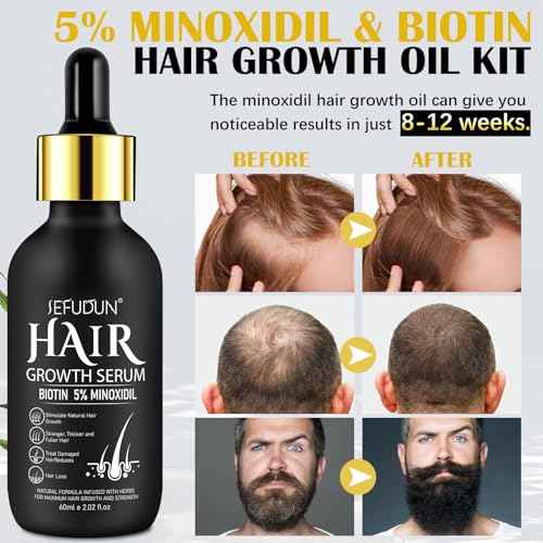 5% Minoxidil Hair Growth Serum Kit, Hair Regrowth Treatment for Scalp Hair Loss and Thinning, With Biotin - 2.02 Fl oz, 1 Month Supply