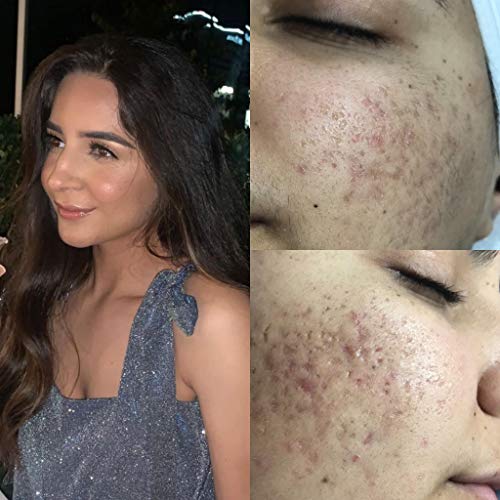 Pro Advanced Hyaluronic Acid Serum for Face, Glow+ Antioxidant Protein-Rich Face Lift Serum with Vitamin C, Niacinamide and B5 for Dry Skin Hydrating and Anti-Aging, 2oz