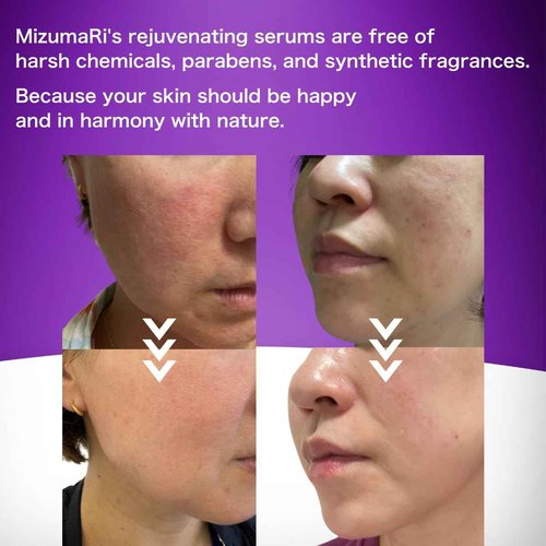 MizumaRi Wrinkle & Lift-Up Face Serum for Dry & Sensitive Skin – Firming & Elasticity Gel, 50ml