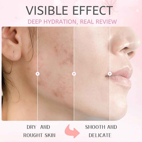 Skincare Kit Sakura Teen Girls Gifts - Skin Care Set Travel Size Toiletries - Sakura Skin Care for Teens 10-12 Hydrating - Teen Facial Kit Gift Set for Women with Bunny Headband（11PCS）