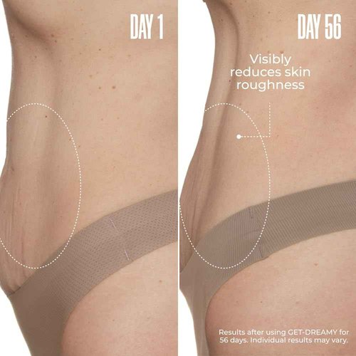 MAËLYS GET-DREAMY Overnight Toning Whip - Body Firming Whip That Works While You Sleep - Helps Skin Look Tighter