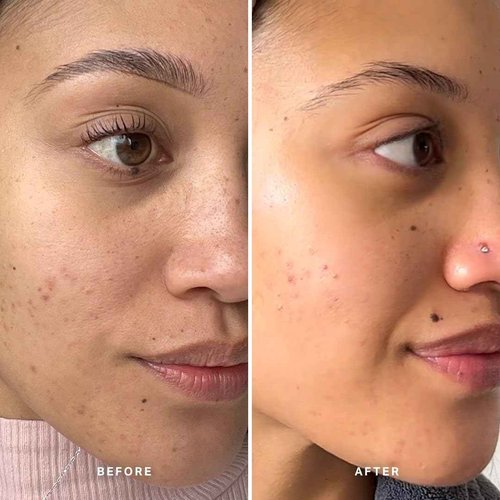 LIQUID GOLD EXFOLIATING TREATMENT WITH 5% GLYCOLIC ACID 100ml