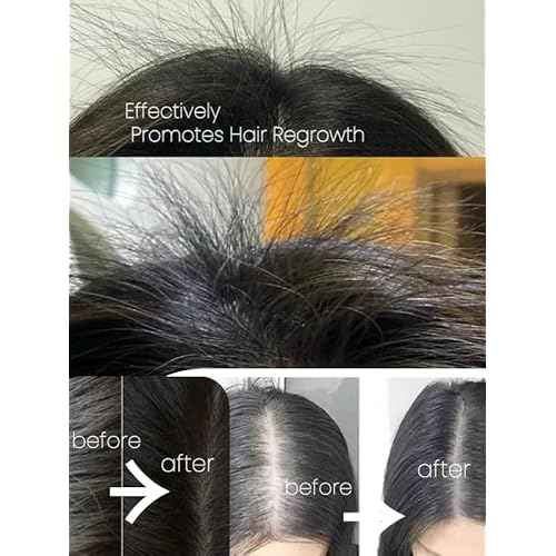 Joy Garden Herbal Scalp Tonic ? Nourishing & Oil-Free Fo-Ti and Arborvitae