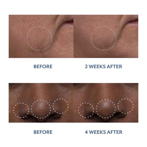 Bloomeffects - Natural Tulip Dew Drops Multi-Nutrient Serum | Cruelty-Free, Non-Toxic, Clean Beauty (1.0 oz | 30 ml)