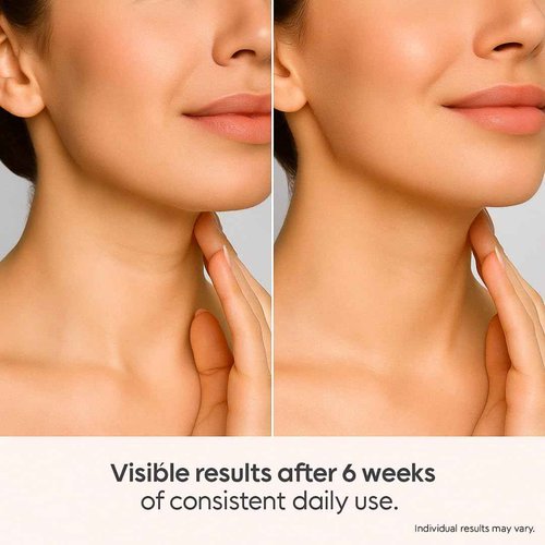 INSANE GLOW V-Y Shape Face & Neck Cream – Anti-Aging Lifting & Firming with 5 Biotech Peptides, Lipofilling Complex & Up-Gravity Complex – Sculpts Jawline, Rejuvenates Skin – Dermatologically Tested