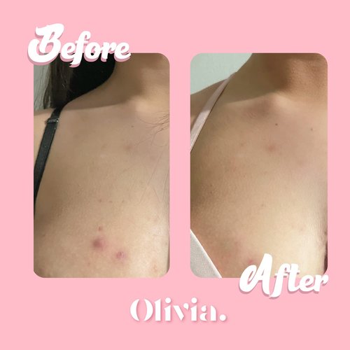 Olivia Buttocks & Breasts Body Exfoliator Scrub & Moisturizer Care Kit