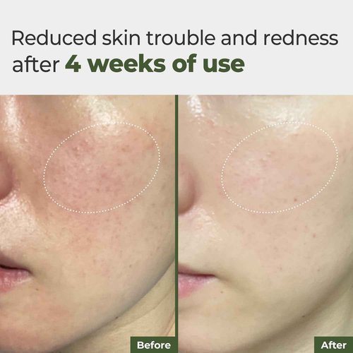 Rbfy. Daily Ampoule Pad – Centella Asiatica Infused Toner Sheets with Antioxidant Deep Nourishing Plant Extracts and Separate Ampoule Pouch for Skin Radiance – (100 Pads)