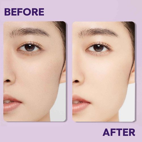 Vacure:treat Eye Cream for Bag Under the Eyes, Dark Circles, Swelling Treatment, Anti-aging, Minimizes Wrinkles, Moisturizing Eyes Cream for Women, Suitable for Sensitive Skin 0.5Fl (15ml), 1 Count
