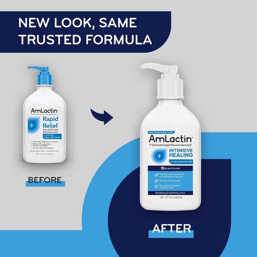 AmLactin Crepe Firming Cream - 12 oz Body Cream with 15% Lactic Acid - Exfoliator and Moisturizer & Intensive Healing Body Lotion for Dry Skin – 14.1 oz Pump Bottle – 2-in-1 Exfoliator