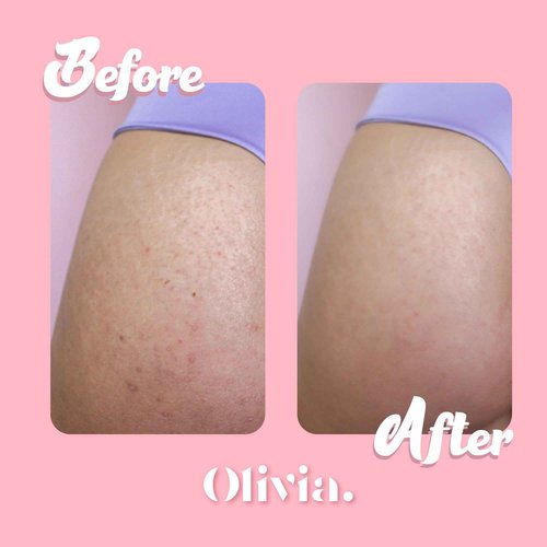 Olivia Buttocks & Breasts Cream and Oil Body Skincare for Dry Skin