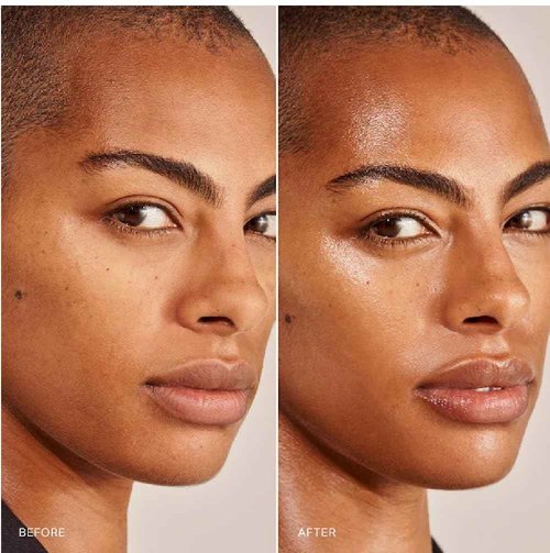 M Great Skin Instant Glow Serum with Niacinamide and Hyaluronic Acid (1.69 oz / 50 ml) + Bonus Acne Patch (36 Pieces) Tea Tree Oil Facial Water Gel