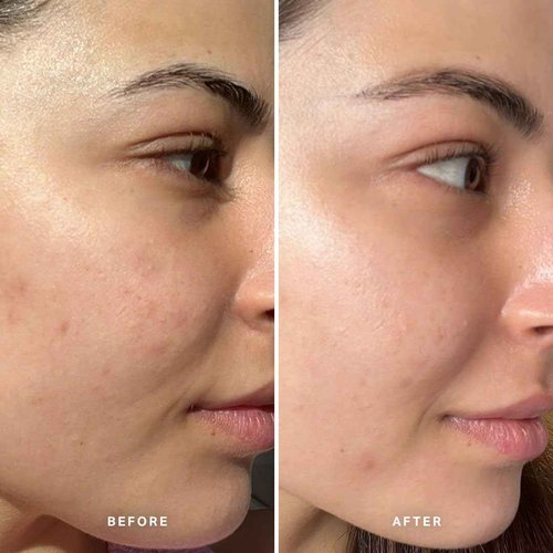 LIQUID GOLD EXFOLIATING TREATMENT WITH 5% GLYCOLIC ACID 100ml