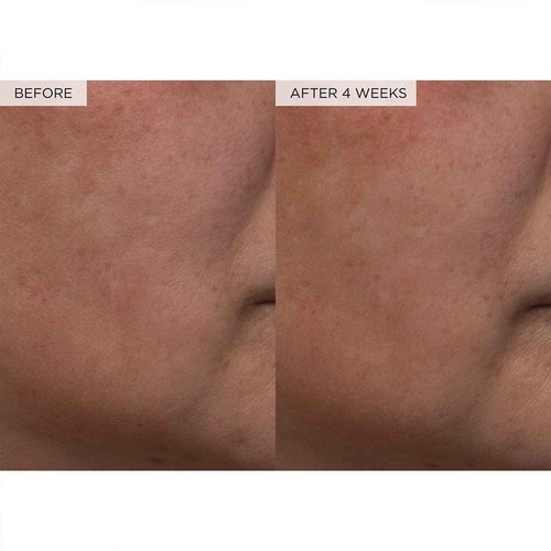 Glow Recipe Toner Duo - Glow Recipe PHA+BHA Pore Minimizer & Facial Exfoliator for Glass Skin - Tightening & Hydrating Skincare with Hyaluronic Acid (150 ml & 40 ml)