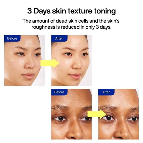 IOPE Gluta Vitamin C Brightening Serum | 25% Pure Vitamin-C and 1,000ppm Glutathione, Anti-Aging and Anti-Oxidant, Reduces Dark Spots, Korean Skincare, 0.78oz.