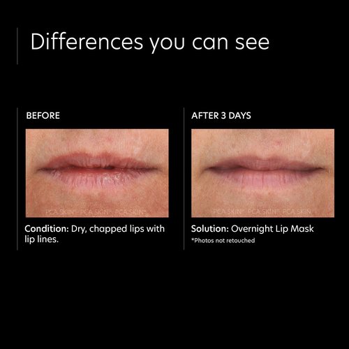 PCA SKIN Overnight Lip Balm Mask — Ultra-Moisturizing Lip Skin Care Treatment, Restores Moisture & Hydrates Dry, Chapped Lips while Sleeping (0.46 oz)