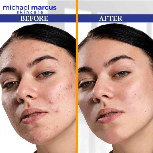 Michael Marcus Hydromarine™ Vitamin C Face Serum PLUS with Hyaluronic Acid & Triple Peptides - Reduce Dark Spots, Anti-Wrinkle, Anti-Aging, & Skin Brightening Vitamin C Serum - (30ml, 1 fl. oz)
