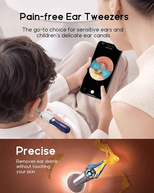 Bebird Earsight Plus D39R Ear Wax Removal Tool Camera, FSA HSA Eligible Items, Ear Cleaner with Flexible Ear Camera Otoscope, Visual Ear Pick Tweezers Wax Remover, Ear Cleaning Kit for Family