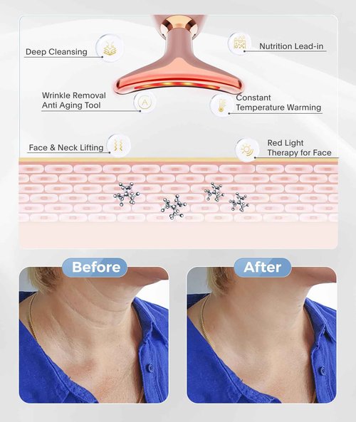 ELISHINE Light Based Face-Neck-Massager - 7 Color Portable Facial Massager for Skin Care, Rose Gold