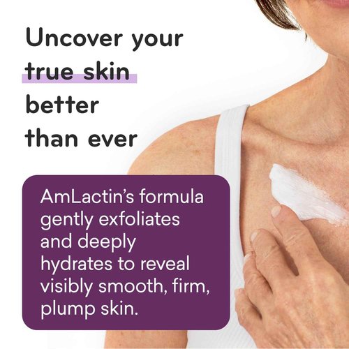 AmLactin Crepe Firming Cream - 12 oz Body Cream with 15% Lactic Acid - Exfoliator and Moisturizer & Intensive Healing Body Lotion for Dry Skin – 14.1 oz Pump Bottle – 2-in-1 Exfoliator