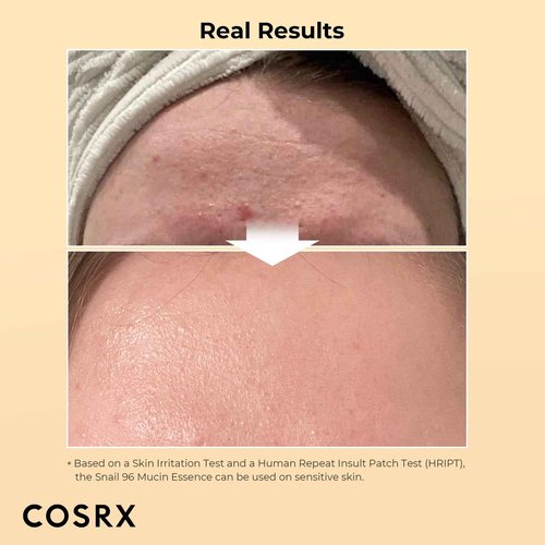 COSRX Advanced Skin Cycling Routine- Vitamin C 23% Serum + Snail 96% Mucin Essence + Snail 92% All In One Cream, Daily Professional Skincare, Improve Radiance & Dark Spots, Korean Skin Care