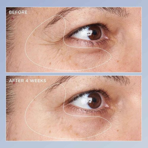 Perricone MD High Potency Triple Retinol Renewal Eye Serum, 0.5 fl. oz.