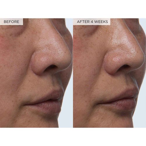 Glow Recipe Toner Duo - Glow Recipe PHA+BHA Pore Minimizer & Facial Exfoliator for Glass Skin - Tightening & Hydrating Skincare with Hyaluronic Acid (150 ml & 40 ml)