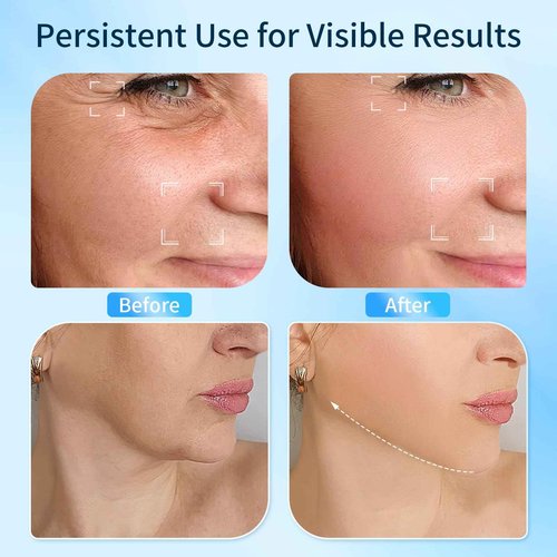 Martvex Facial Massager for Face and Neck - Face S culpting Tool with 7 Color, Christmas Gift for Men and Women, Mothers Day, Fathers Day, Valentine's Day