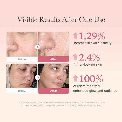 medicube Affordable Value Trio for Pore & Texture Care: Zero Pore Pads 2.0 and Zero Exosome Shot 7,500 PPM Spicule Facial Serum and Collagen Jelly Cream (110ml)