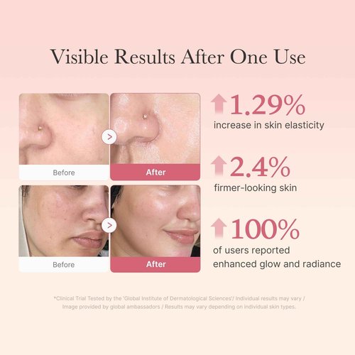 medicube Affordable Trio for Pore & Texture Care: Zero Pore Pads 2.0 and Zero Exosome Shot 7,500 PPM Spicule Facial Serum and Collagen Jelly Cream-50ml