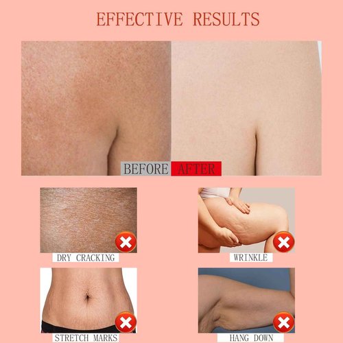 POYICGS Magic Body Firming Oil – Full Body Use, Hydrating and Firming Skin Oil for Arms, Chest, and Thighs – with Vitamin E, Rosehip