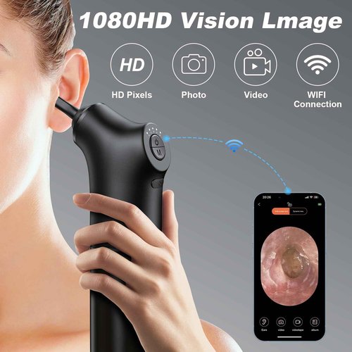 Ear Wax Removal Kit Electric Ear Cleaner Water Powered Ear Cleaner with 4 Pressure Modes 10 Ear Tips, Safe and Effective Ear Cleaning Tool Water Resistant USB Rechargeable