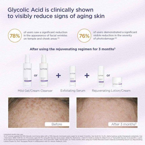 Glytone Mild Cream Cleanser | Exfoliate & Moisturize with 3.4 Free Acid Value Glycolic Acid & Glycerin | Face Wash for Women Removes Makeup & Oil | Face Cleanser for Dry Skin | 13.5 Fl oz.