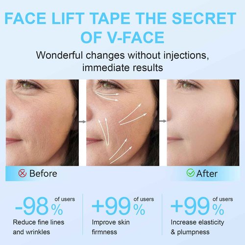 Kvrueten 180PCS Face Lift Tape & Neck Lift Tape - Instant V-Shaped Face