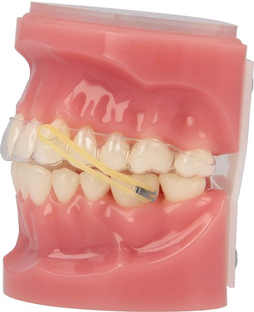 American Orthodontics Elastics Wildlife Gorilla | Medium, 4.5 Oz, 3/16" Size, 100 Packs Per Box, 10,000 Total | Made in The USA | Exacting Dimensions, Precision Cutting, Top Quality Latex Tubing