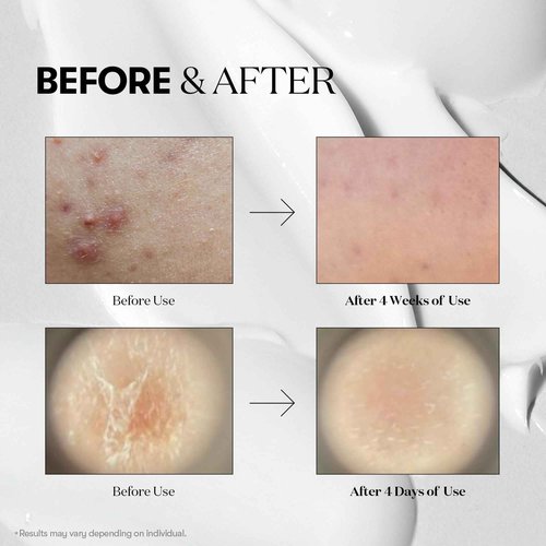 VT COSMETICS Bundle CICA Reedle Shot 700 & Cica Cream Plus