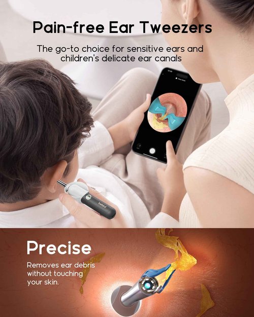 Bebird Earsight Plus R37R Ear Cleaning Camera Wax Removal Tool kit, Flexible Ear Scope Otoscope Camera Light, Visual Ear Picker Wireless Earwax Remover Tweezers for Adults & Kids