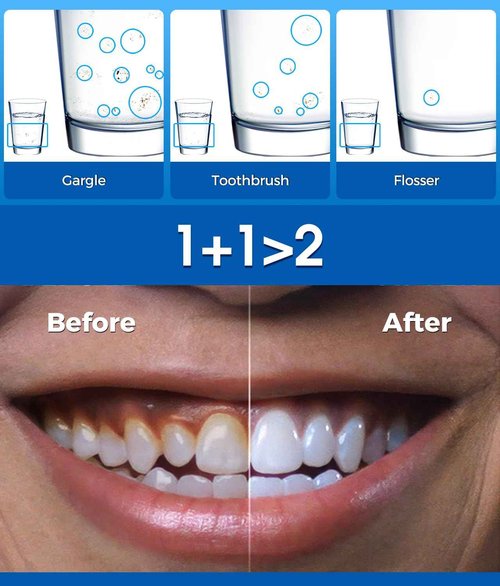 Electric Toothbrush and Water Flosser,600ML Oral Irrigator Water Flosser with 7 Jet Tips,10 Adjustable Pressure Settings,Sonic Electric Toothbrush with 2 Brush Heads,5 Modes(White)