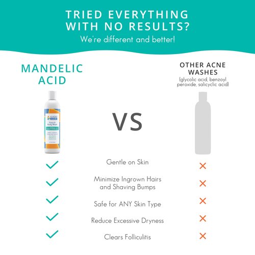 Almond Clear Face & Body Wash | Skin Care for Acne and Folliculitis-Prone Skin - Gentle Acne Face & Body Wash, Exfoliating Cleanser with Mandelic Acid | 17.25 oz