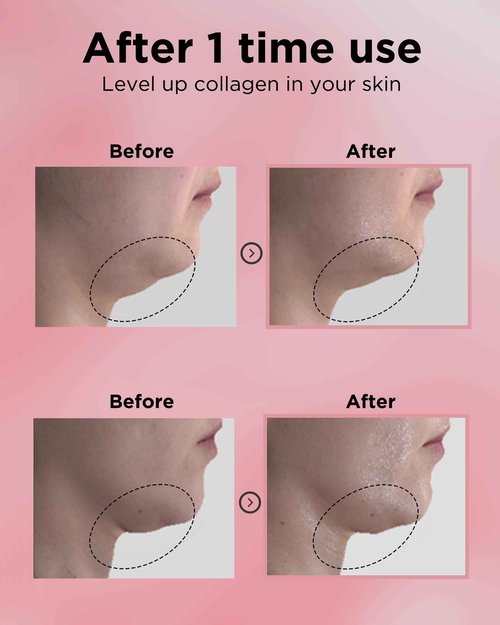 EASYDEW DW-EGF 55% Collagen Silkream Ampoule- Korean Facial Serum for Firmness & Elasticity with EGF Peptides, Amino Acids - Day & Night Age-Defying Silky Smooth Skincare, 1.86oz.